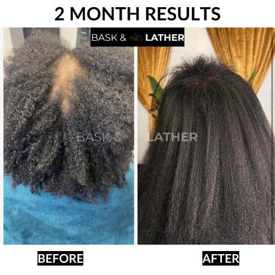 Healthy Hair Starter Kit- Limited Edition